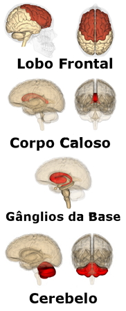 Partes do Cérebro Afetadas pela Hiperatividade